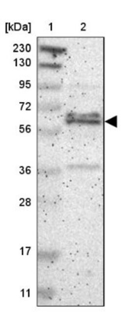 ZNF135 Antibody, Novus Biologicals 0.1mL; Unlabeled:Antibodies, Polyclonal